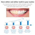 Non Peroxide Whitening Strips Manufacturer - Private Label White Tooth Dental Kit Oral Hygiene