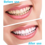 Natural Whitening Strips Factory - Hot Selling Easy for Adults Convenient Teeth Whitening Solution
