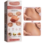 Body Cream Supplier - Effective Body Cream for Stretch Mark and Pregnancy Scar Removal Personal Care