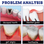 Toothache Spray Manufacturer - Herbal Toothache Relief Spray for Swollen Gums Periodontitis Cavities Care