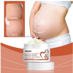 Skin Repair Cream Supplier - Wholesale Healthcare Supply Skin Repair Cream for Stretch Mark Scar Removal