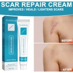 Scar Repair Cream Manufacturer - West Month Scar Repair Cream for Surgical and Burn Anti Scar