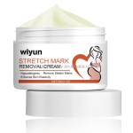 Skin Repair Cream Supplier - Wholesale Healthcare Supply Skin Repair Cream for Stretch Mark Scar Removal