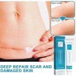 Scar Repair Cream Manufacturer - West Month Scar Repair Cream for Surgical and Burn Anti Scar