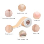 Dermatologist Scar Tape Manufacturer - Self Adhesive Silicone Scar Tape Dermatologist Tested for Old New Scars