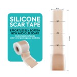 Scar Tape Manufacturer - Self Adhesive Scar Management Tape Medical Grade Silicone