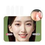 Ear Corrector Factory - High Quality Elf Ear Corrector Stickers for Rehabilitation Therapy Cosmetic Ear Correction