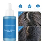 Hair-Loss Prevention Manufacturer - 20ML Private Label Hair Growth Hair-Loss Prevention Oil Repair Smoothing Scalp Wellness