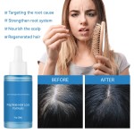 Hair-Loss Prevention Manufacturer - 20ML Private Label Hair Growth Hair-Loss Prevention Oil Repair Smoothing Scalp Wellness