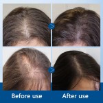 Hair Care Oil Factory - 20ML Private Label Hair Care Natural Organic Prevents Hair Loss Serum Nourishing Growing Strong