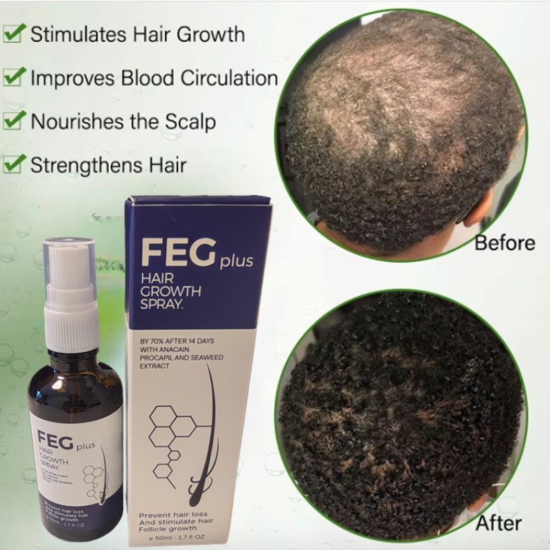 Hair Growth Serum Supplier - Hot Sale Quality Guaranteed Anti Fake 2025