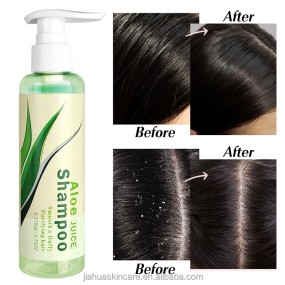 Hair Shampoo Manufacturer - Hot Selling Aloe Vera