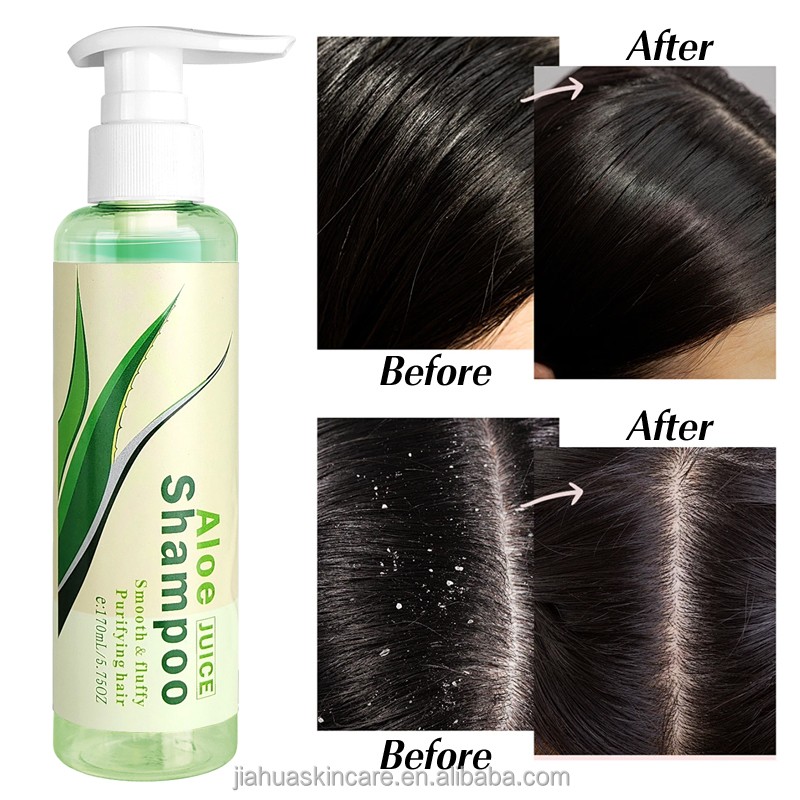 Hair Shampoo Manufacturer - Hot Selling Aloe Vera