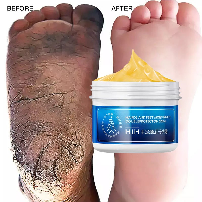 Repair Cream Supplier - Hot Selling HIH Dry Skin Hand and Foot Repair Intensive Moisturizing Cracked