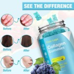 Collagen Gummies Manufacturer - OEM Factory Price Skin Whitening
