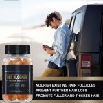 DHT Blocker Gummies Manufacturer - Saw Palmetto Biotin Prostate