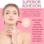 面部痘痘贴生产商-定制圆形瑕疵覆盖