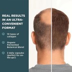 Hair Growth Tablets Manufacturer - Own Brand Dietary Supplement for Healthy Hair
