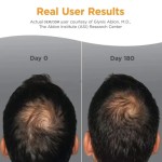 Hair Growth Supplement Tablets Supplier - Hot Selling Scientific Nutrition Formula