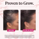 Female Hair Growth Tablets Supplier - OEM Natural Biotin Dietary Supplement