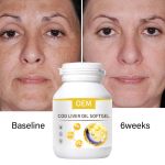 Cod Liver Oil Softgel Factory - OEM Custom Immunity Calcium