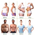 Slimming Supplement Manufacturer - OEM Custom Probiotic Detox