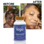 Collagen Soft Capsule Manufacturer - OEM Custom Glutathione Brightening