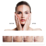 Skin Whitening Capsules Manufacturer - OEM Custom Anti Aging Softgel