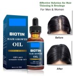 OEM Biotin Hair Growth Oil 30ML Benefits Most Types of Hair Healthy Supplement for Hair Strengthen and Best Growth Care