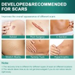OEM/ODM Silicone Scar Sheets Silicone Scar Tape Reusable and Effective Scar Removal Sheets