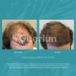 生发片工厂 - 专业再生更长