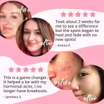 胶原蛋白胶囊供应商 - 生物素角蛋白玻尿酸代工