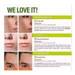 Acne Capsules Manufacturer - Vegan Skin Care Supplement