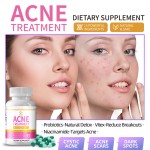 祛痘胶囊生产厂家 - 烟酰胺益生菌治疗