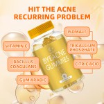 祛痘软糖厂家 - 草本补充剂红肿消除