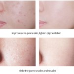 微针精华供应商 - EGF冻干粉贴牌