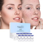 微针精华供应商 - EGF冻干粉贴牌