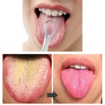 舌刮工厂 - 免费样品U型钢