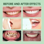 牙膏片供应商 - 先进美白纳米羟基磷灰石