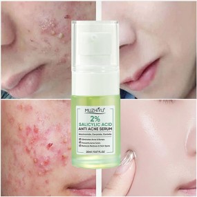 Acne Serum Factory - Private Label Salicylic Acid Removal