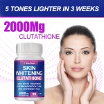 Skin Whitening Capsules Factory - OEM Custom L-Glutathione Vitamins Pills