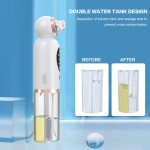 美容设备生产厂家 - 超声波面部毛孔清洁