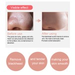 牙膏厂家 - 薄荷味牙龈保护