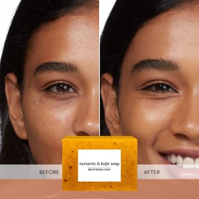 热卖曲酸皂姜黄皂与工厂价格