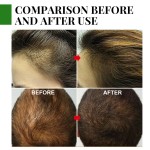 Private Label Natural Castor Oil for Hair Serum Anti Loss Regrowth for Bald Rosemary Oil Treatment Biotin Hair Growth Serum Oil