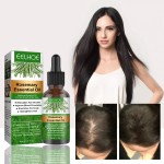 Private Label Natural Castor Oil for Hair Serum Anti Loss Regrowth for Bald Rosemary Oil Treatment Biotin Hair Growth Serum Oil