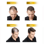 生物素软糖供应商 - 头发生长女性白标