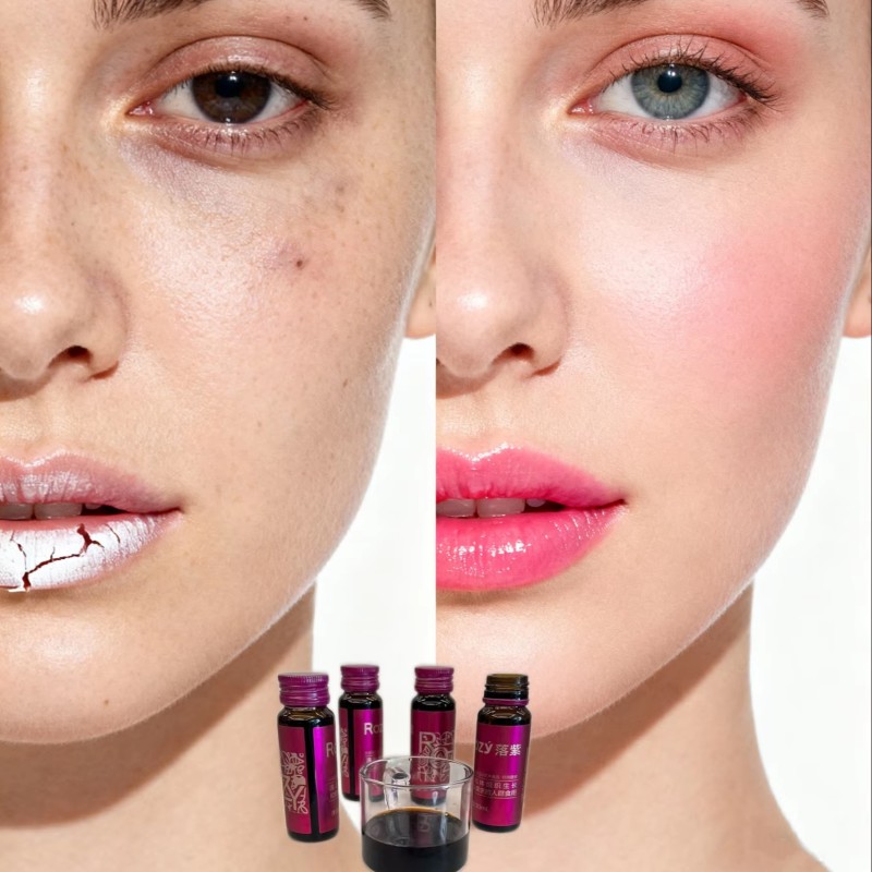 OEMWholesaleShippingReplenishQiBloodCollagenCalmingComprehensiveSupportWomen's BodyBest-sellingPatentcomplexionImprove