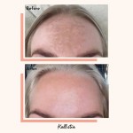 纯素清洁胶囊供应商 - 可定制肌肤护理色素沉着草本