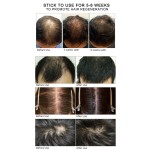 头发护理生产厂家 - 30毫升有机受损护理